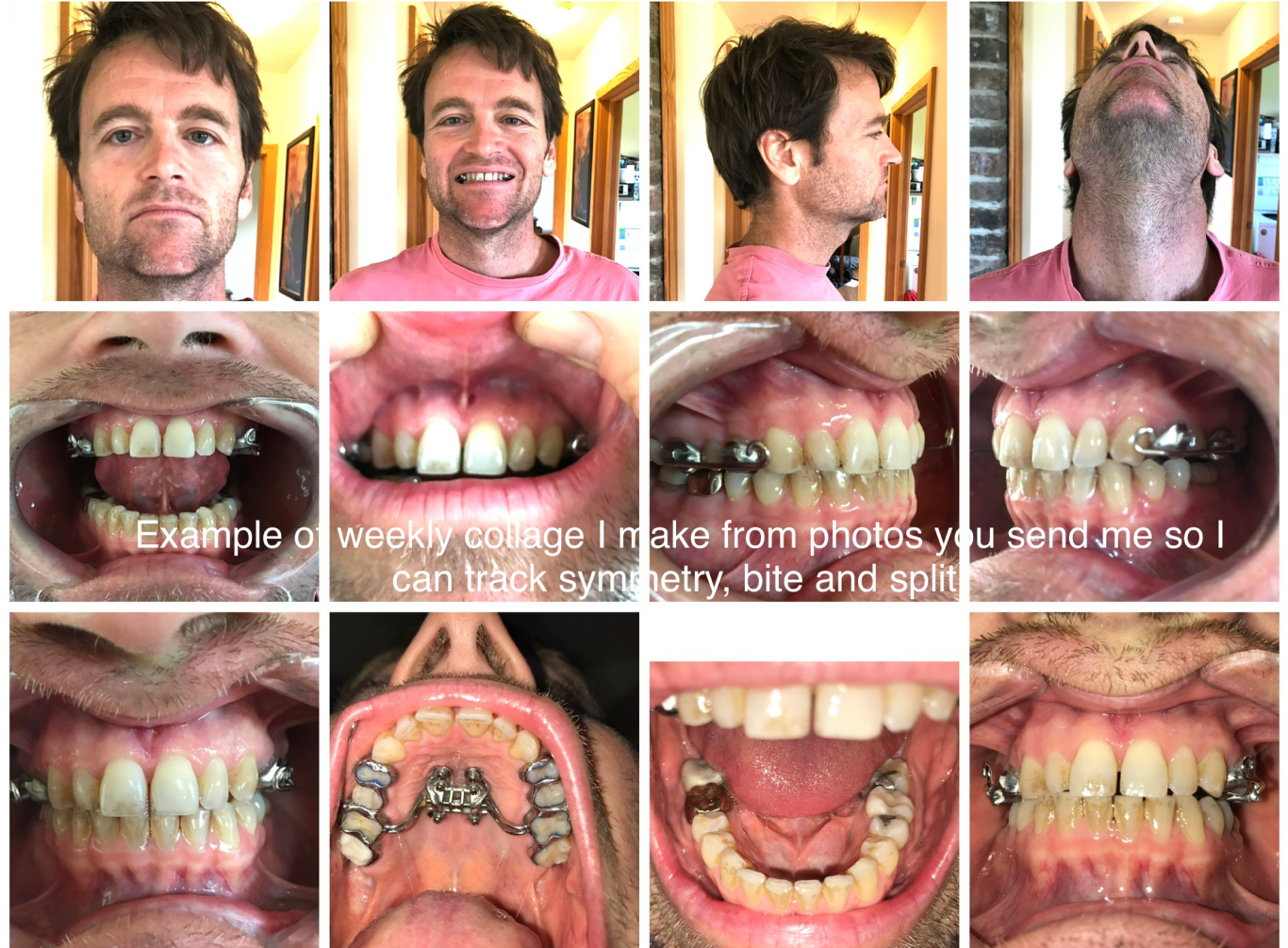 follow up series of progress photos