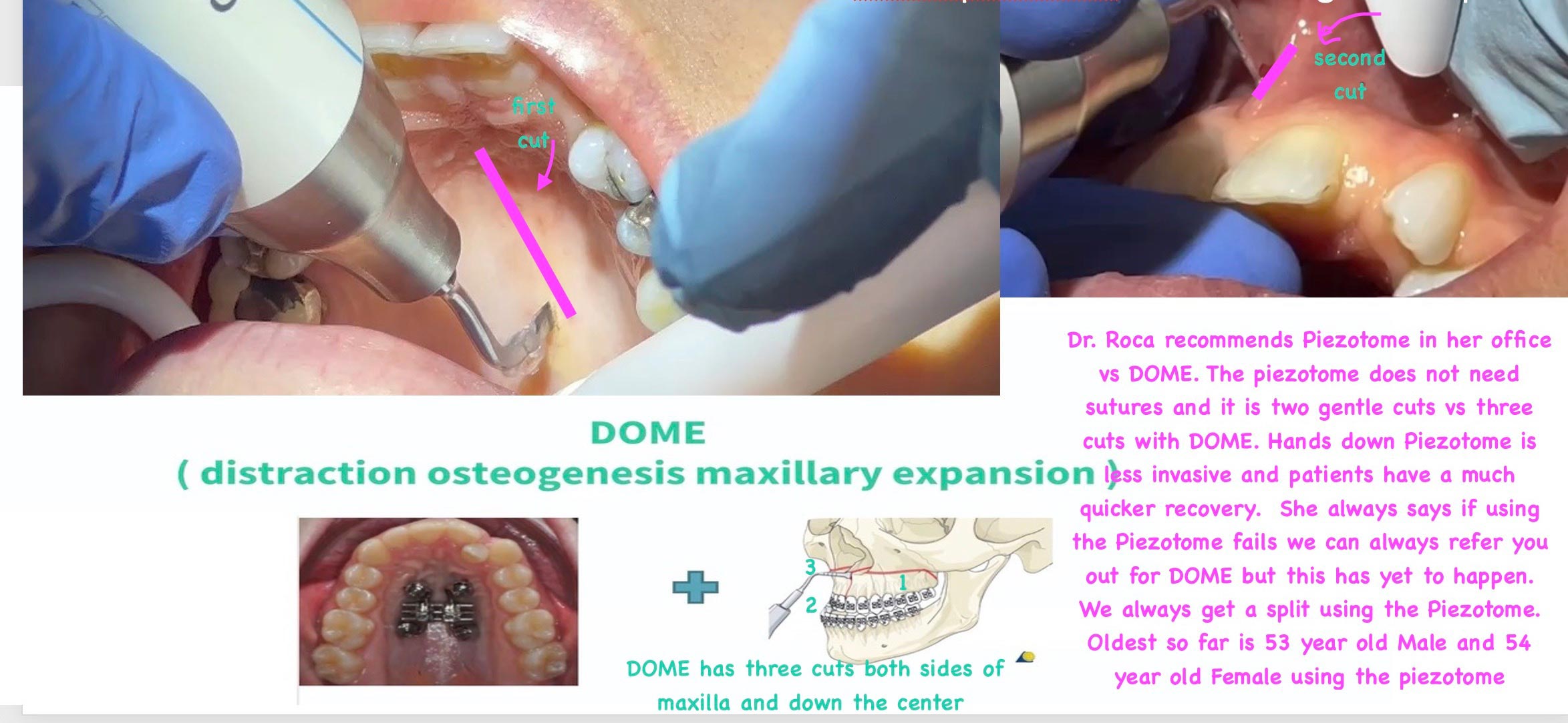 teeth before treatment